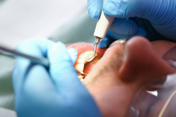 Best Cosmetic Emergency Dentistry in Ackerman, MS